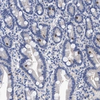 Immunohistochemical staining of human duodenum shows strong membranous positivity in enteroendocrine cells.