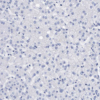 Immunohistochemical staining of human liver shows no membranous positivity in hepatocytes as expected.