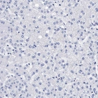 Immunohistochemical staining of human liver shows no membranous positivity in hepatocytes as expected.