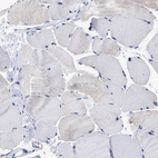 Immunohistochemical staining of human skeletal muscle shows no membranous positivity in myocytes as expected.