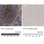 Anti-SIT1 Antibody