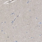 Immunohistochemical staining of human cerebral cortex shows low expression as expected.