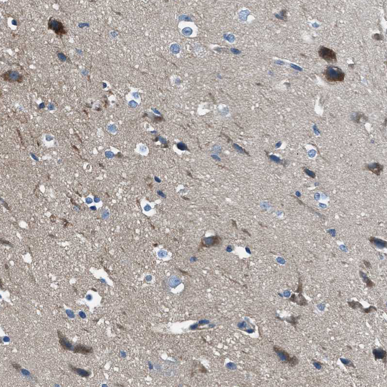 Anti-SLC38A6 Antibody