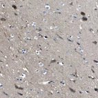 Anti-SLC38A6 Antibody