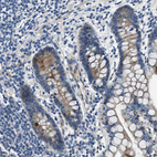 Immunohistochemical staining of human small intestine shows moderate membranous positivity in glandular cells.