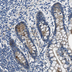 Anti-SLC38A6 Antibody
