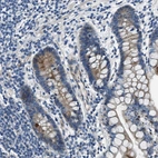 Immunohistochemical staining of human small intestine shows moderate membranous positivity in glandular cells.