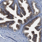 Immunohistochemical staining of human prostate shows strong membranous positivity in glandular cells.