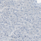 Immunohistochemical staining of human liver shows no positivity in glandular cells as expected.