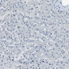Immunohistochemical staining of human liver shows no positivity in glandular cells as expected.