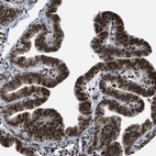 Immunohistochemical staining of human Fallopian tube shows strong nuclear positivity in glandular cells.