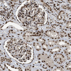 Immunohistochemical staining of human Kidney shows strong nuclear positivity in cells in tubules and in glomeruli.
