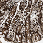 Immunohistochemical staining of human Duodenum shows strong nuclear positivity in glandular cells.