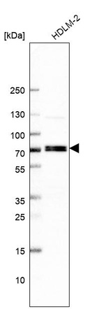 Western blot analysis in human cell line HDLM-2.