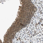 Immunohistochemical staining of human urinary bladder shows moderate cytoplasmic positivity in urothelial cells.