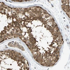 Immunohistochemical staining of human testis shows strong cytoplasmic positivity in cells in seminiferous ducts.