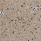 Immunohistochemical staining of human cerebral cortex shows moderate cytoplasmic positivity in neurons.