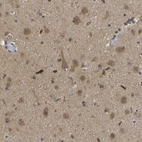 Immunohistochemical staining of human cerebral cortex shows moderate cytoplasmic positivity in neurons.