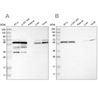 Western blot analysis using Anti-CCT8 antibody HPA018520 (A) shows similar pattern to independent antibody HPA021051 (B).