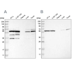 Western blot analysis using Anti-CCT8 antibody HPA018520 (A) shows similar pattern to independent antibody HPA021051 (B).
