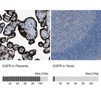 Anti-EGFR Antibody