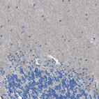 Immunohistochemical staining of human cerebellum shows no positivity in Purkinje cells as expected.
