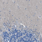 Immunohistochemical staining of human cerebellum shows no positivity in Purkinje cells as expected.