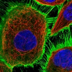 Immunofluorescent staining of human cell line A-431 shows positivity in plasma membrane.