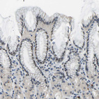 Immunohistochemical staining of human stomach shows moderate to strong nuclear positivity in glandular cells.