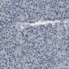 Immunohistochemical staining of human pancreas shows very weak and few nuclear positivity in exocrine glandular cells.