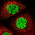 Immunofluorescent staining of human cell line A-431 shows localization to nucleoplasm.