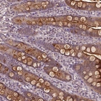 Immunohistochemical staining of human duodenum shows high expression.