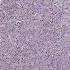 Immunohistochemical staining of human pancreas shows low expression as expected.
