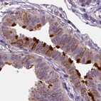 Immunohistochemical staining of human fallopian tube using Anti-ANXA13 antibody HPA018535.