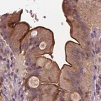 Immunohistochemical staining of human small intestine using Anti-ANXA13 antibody HPA018535.