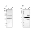 Western blot analysis using Anti-ANXA13 antibody HPA018535 (A) shows similar pattern to independent antibody HPA019650 (B).