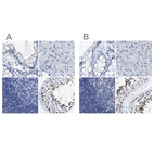 Immunohistochemical staining of human colon, liver, lymph node and testis using Anti-HOOK1 antibody HPA018537 (A) shows similar protein distribution across tissues to independent antibody HPA018820 (B).