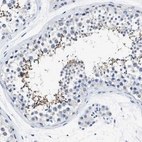 Immunohistochemical staining of human testis shows weak to moderate positivity in spermatozoa and spermatids.