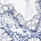Immunohistochemical staining of human colon using Anti-HOOK1 antibody HPA018537.