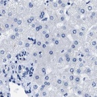 Immunohistochemical staining of human liver using Anti-HOOK1 antibody HPA018537.