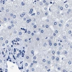 Immunohistochemical staining of human liver using Anti-HOOK1 antibody HPA018537.