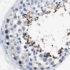 Immunohistochemical staining of human testis using Anti-HOOK1 antibody HPA018537.