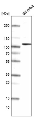 Western blot analysis in human cell line SK-BR-3.
