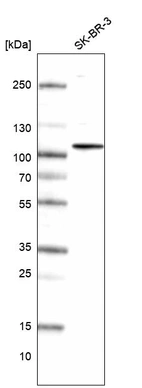 Western blot analysis in human cell line SK-BR-3.