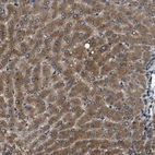 Immunohistochemical staining of human liver shows strong cytoplasmic positivity in hepatocytes.