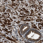 Immunohistochemical staining of human prostate shows strong cytoplasmic positivity in smooth muscle cells and glandular cells.