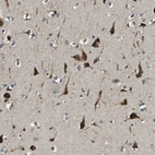 Immunohistochemical staining of human cerebral cortex shows moderate to strong cytoplasmic positivity in neurons.