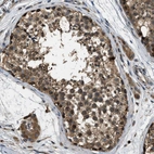 Immunohistochemical staining of human testis shows moderate to strong cytoplasmic positivity in cells in seminiferous ducts.