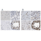 Immunohistochemical staining of human cerebral cortex, kidney, skeletal muscle and testis using Anti-SCAF4 antibody HPA018668 (A) shows similar protein distribution across tissues to independent antibody HPA018319 (B).