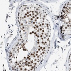 Immunohistochemical staining of human testis shows high expression.